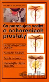 Čo potrebujete vedieť o ochoreniach prostaty
