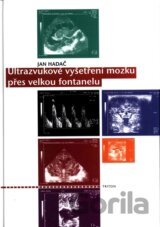 Ultrazvukové vyšetření mozku přes velkou fontanelu