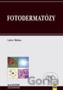 Fotodermatózy