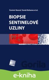 Biopsie sentinelové uzliny