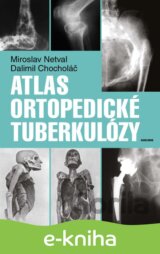 Atlas ortopedické tuberkulózy