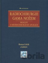 Radiochirurgie gama nožem