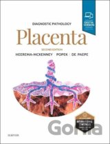 Diagnostic Pathology: Placenta