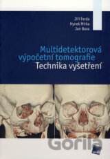 Multidetektorová výpočetní tomografie