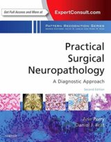Practical Surgical Neuropathology: A Diagnostic Approach