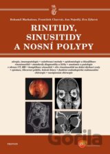 Rinitidy, sinusitidy a nosní polypy