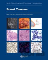 Who Classification of Tumours: Breast Tumours