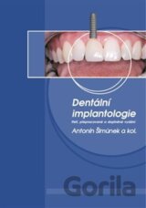 Dentální implantologie