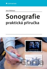 Sonografie