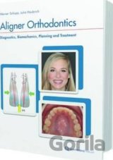 Aligner Orthodontics