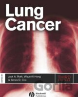 Lung Cancer