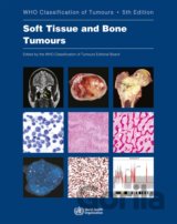 Soft Tissue and Bone Tumours