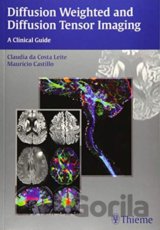 Diffusion Weighted and Diffusion Tensor Imaging