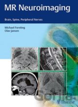 MR Neuroimaging