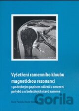 Vyšetření ramenního kloubu magnetickou rezonancí