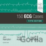 150 ECG Cases