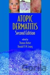 Atopic Dermatitis