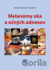 Melanómy oka a očných adnexov
