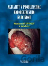 Aktuality v problematike kolorektálneho karcinómu