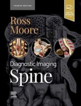Diagnostic Imaging: Spine
