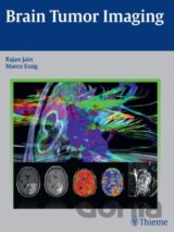 Brain Tumor Imaging