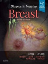 Diagnostic Imaging: Breast