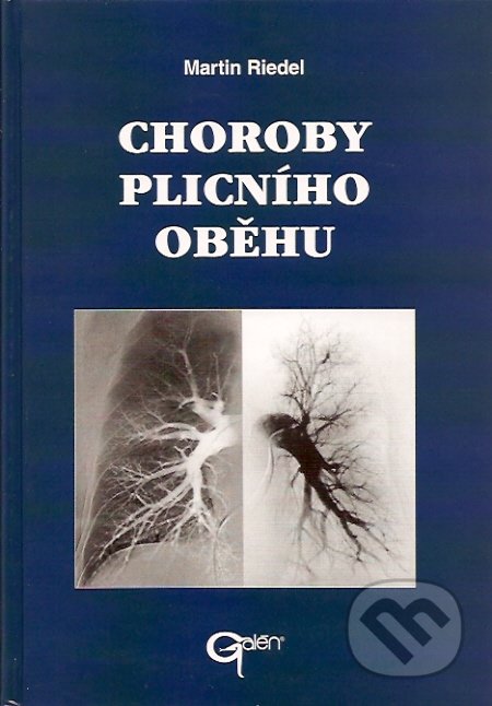 Choroby plicního oběhu - Martin Riedel, Galén, 2000