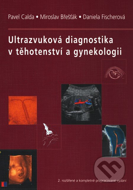 Ultrazvuková diagnostika v těhotenství a gynekologii - Pavel Calda a kol., Aprofema, 2010