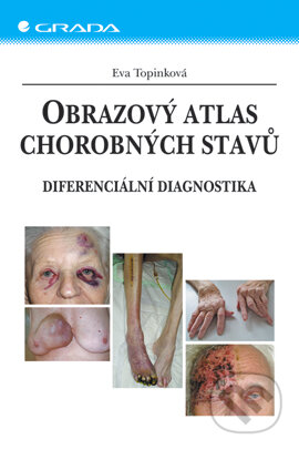 Obrazový atlas chorobných stavů - Eva Topinková, Grada, 2006