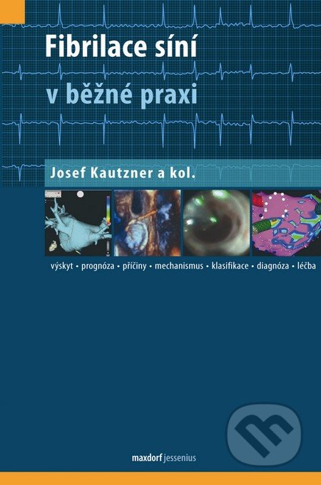 Fibrilace síní v běžné praxi - Josef Kautzner a kol., Maxdorf, 2012