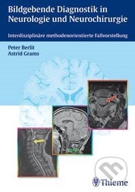 Bildgebende Diagnostik in Neurologie und Neurochirurgie - Peter Berlit, Thieme, 2010