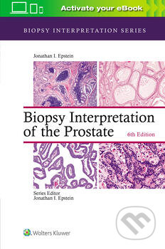 Biopsy Interpretation of the Prostate - Jonathan I. Epstein, Lippincott Williams & Wilkins, 2019