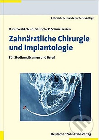 Zahnärztliche Chirurgie und Implantologie - Ralf Gutwald, N. -C. Gellrich, Rainer Schmelzeisen, Deutscher Aerzte, 2018