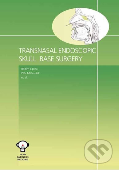 Transnasal Endoscopic Skull Base Surgery - autorů kolektiv, Tobiáš, 2016