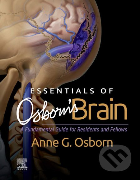 Essentials of Osborn&#039;s Brain - Anne G. Osborn, Elsevier Science, 2019