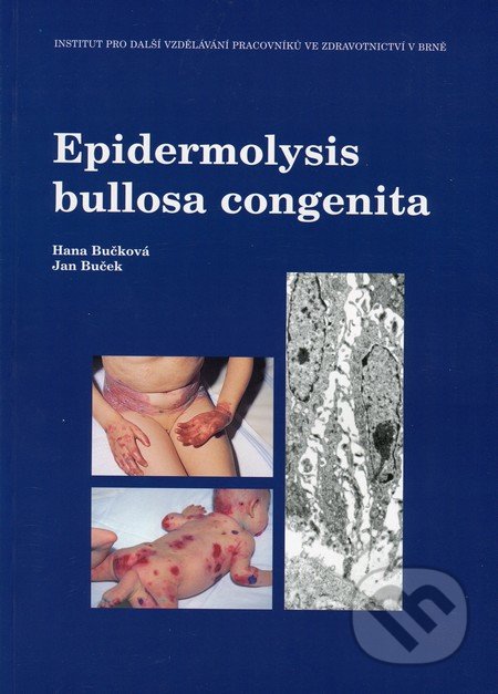 Epidermolysis bullosa congenita - Hana Bučková, Jan Buček, Národní centrum ošetrovatelství (NCO NZO), 2000