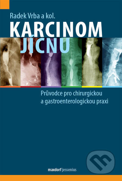 Karcinom jícnu - Radek Vrba , kolektív autorů, Maxdorf, 2021