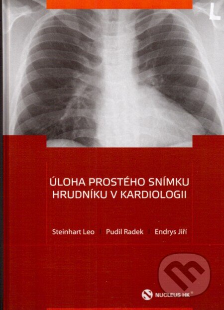 Úloha prostého snímku hrudníku v kardiologii - Leo Steinhart, Radek Pudil, Endrys Jiří, Nucleus HK, 2012