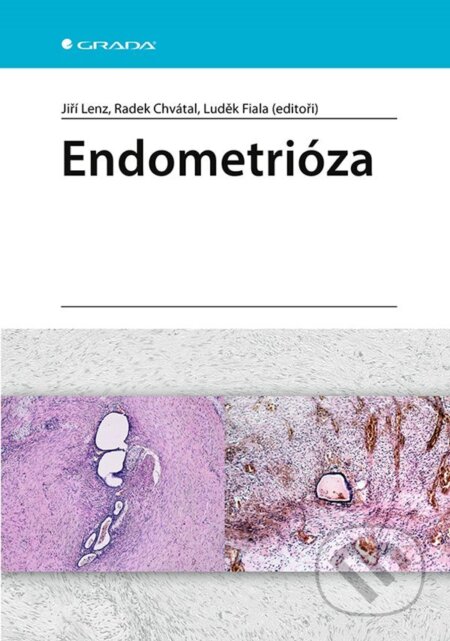 Endometrióza - Jiří Lenz, Radek Chvátal, Luděk Fiala, Grada, 2021