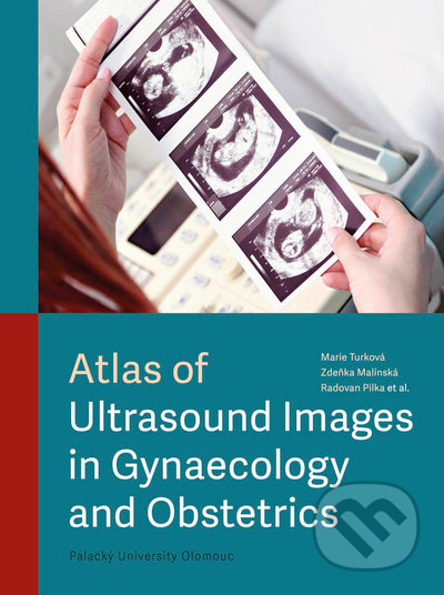 Atlas of Ultrasound Images in Gynaecology and Obstetrics - Marie Turková, Zdeňka Malínská, Radovan Pilka, kolektiv autorů, Univerzita Palackého v Olomouci, 2022