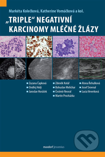 „Triple“ negativní karcinomy mléčné žlázy - Markéta Kolečková, Katherine Vomáčková, Maxdorf, 2022