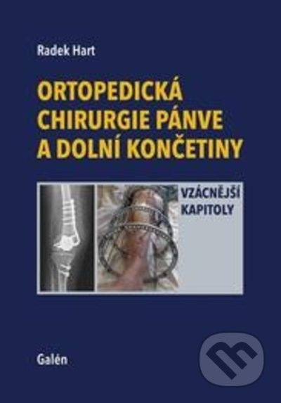 Ortopedická chirurgie pánve a dolní končetiny - Radek Hart, Galén, 2022