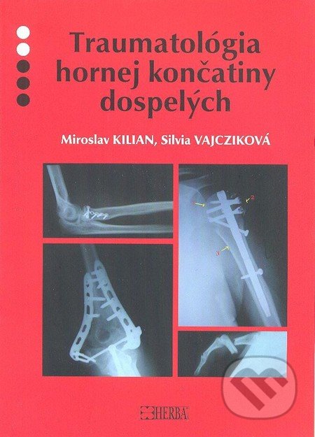 Traumatológia hornej končatiny dospelých - Miroslav Kilian, Silvia Vajcziková, Herba, 2012
