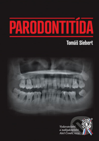 Parodontitída - Tomáš Siebert, Aleš Čeněk, 2022