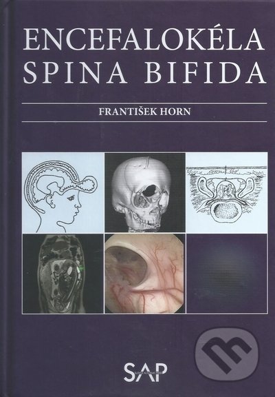 Encefalokéla spina bifida - František Horn, Slovak Academic Press, 2022