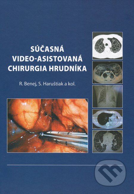 Súčasná video-asistovaná chirurgia hrudníka - Roman Benej, Svetozár Haruštiak a kolektív, Vydavateľstvo P + M, 2013