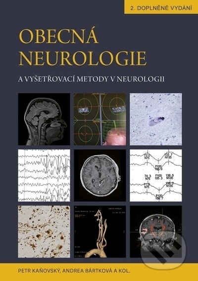 Obecná neurologie a vyšetřovací metody v neurologii - Petr Kaňovský, Andrea Bártková, Univerzita Palackého v Olomouci, 2022