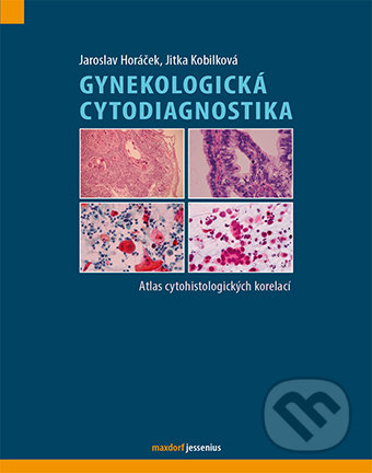 Gynekologická cytodiagnostika - Jaroslav Horáček, Jitka Kobilková, Maxdorf, 2013