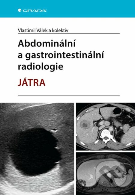 Abdominální a gastrointestinální radiologie - Vlastimil Válek a kolektiv, Grada, 2023
