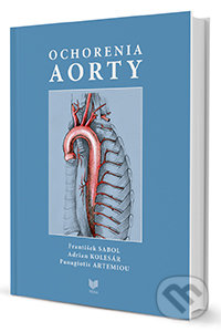Ochorenia aorty - František Sabol, Adrian Kolesár, Panagiotis Artemiou, VEDA, Východoslovenský ústav srdcových a cievnych chorôb, 2015